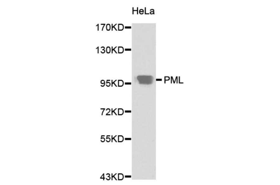 Western blot - PML Antibody from Signalway Antibody (32211) - Antibodies.com