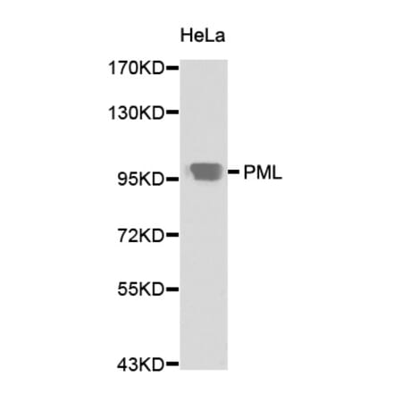 Western blot - PML Antibody from Signalway Antibody (32211) - Antibodies.com