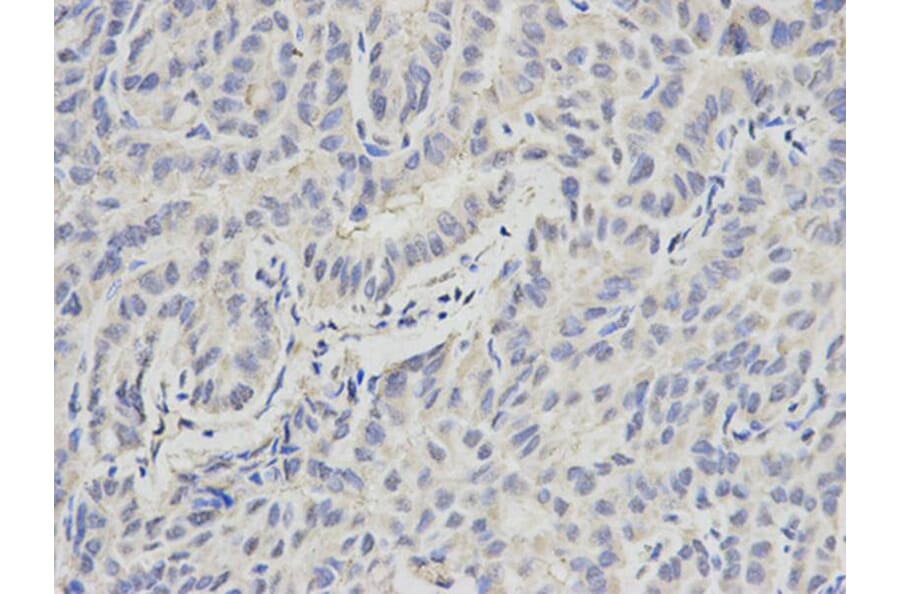 Immunohistochemistry - PML Antibody from Signalway Antibody (32211) - Antibodies.com