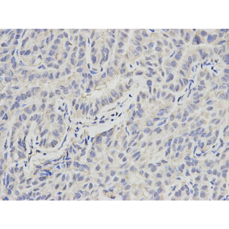 Immunohistochemistry - PML Antibody from Signalway Antibody (32211) - Antibodies.com