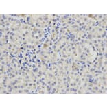 Immunohistochemistry - PML Antibody from Signalway Antibody (32211) - Antibodies.com