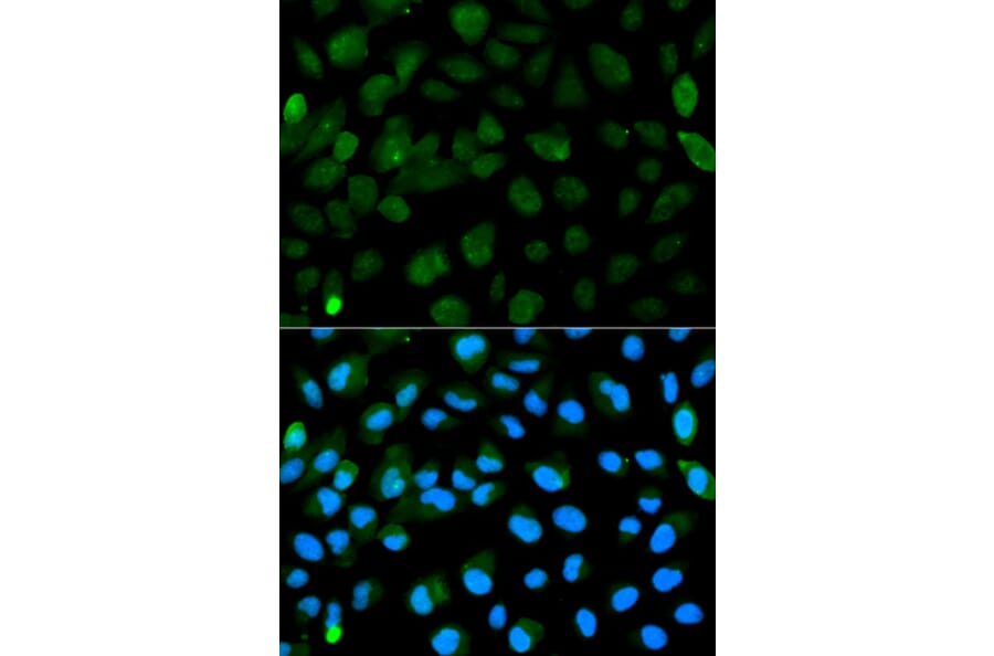Immunofluorescence - PML Antibody from Signalway Antibody (32211) - Antibodies.com