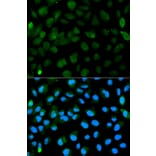 Immunofluorescence - PML Antibody from Signalway Antibody (32211) - Antibodies.com