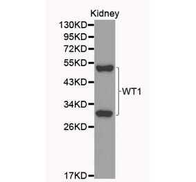 Western blot - WT1 Antibody from Signalway Antibody (32222) - Antibodies.com