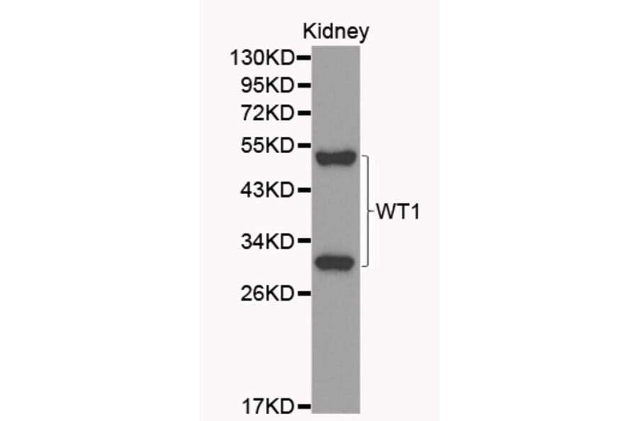 Western blot - WT1 Antibody from Signalway Antibody (32222) - Antibodies.com