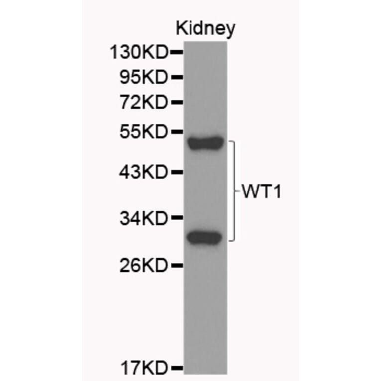 Western blot - WT1 Antibody from Signalway Antibody (32222) - Antibodies.com