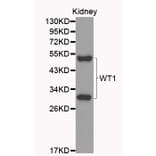 Western blot - WT1 Antibody from Signalway Antibody (32222) - Antibodies.com