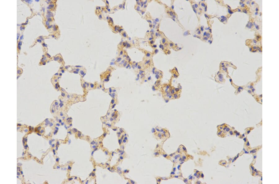 Immunohistochemistry - WT1 Antibody from Signalway Antibody (32222) - Antibodies.com