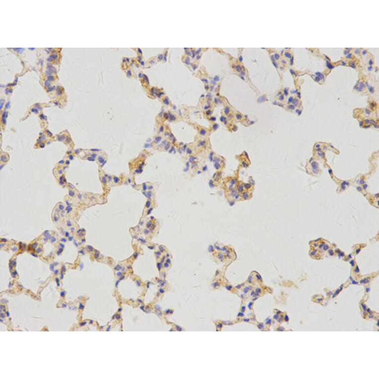 Immunohistochemistry - WT1 Antibody from Signalway Antibody (32222) - Antibodies.com