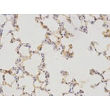 Immunohistochemistry - WT1 Antibody from Signalway Antibody (32222) - Antibodies.com