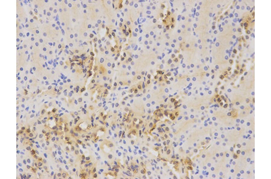 Immunohistochemistry - WT1 Antibody from Signalway Antibody (32222) - Antibodies.com