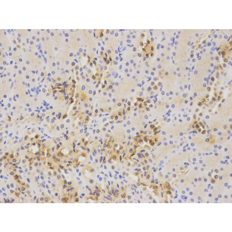 Immunohistochemistry - WT1 Antibody from Signalway Antibody (32222) - Antibodies.com