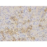 Immunohistochemistry - WT1 Antibody from Signalway Antibody (32222) - Antibodies.com