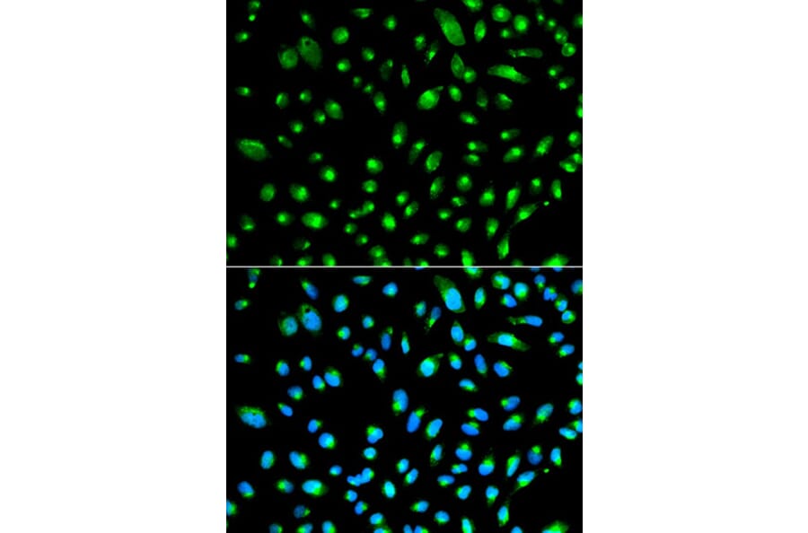 Immunofluorescence - WT1 Antibody from Signalway Antibody (32222) - Antibodies.com