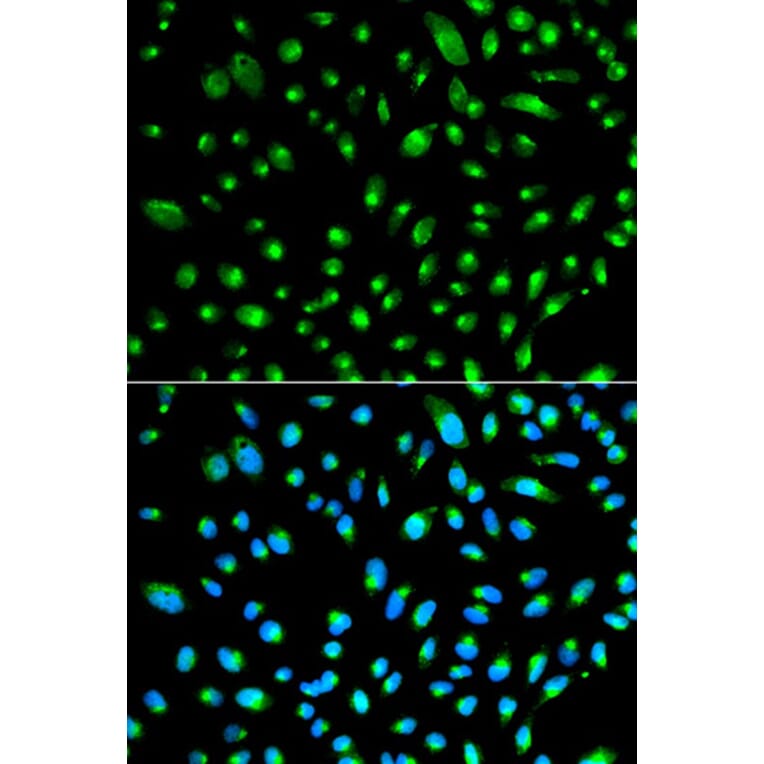 Immunofluorescence - WT1 Antibody from Signalway Antibody (32222) - Antibodies.com