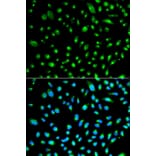 Immunofluorescence - WT1 Antibody from Signalway Antibody (32222) - Antibodies.com