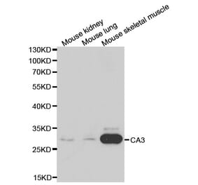 Western blot - CA3 Antibody from Signalway Antibody (32231) - Antibodies.com