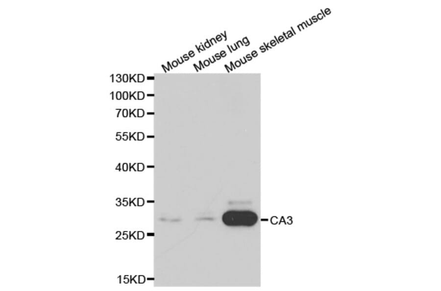 Western blot - CA3 Antibody from Signalway Antibody (32231) - Antibodies.com
