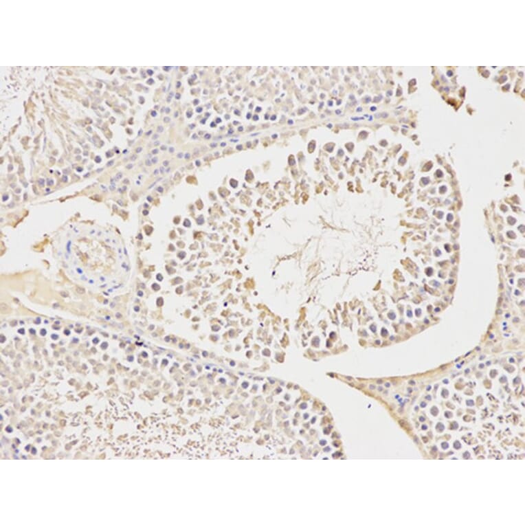Immunohistochemistry - CA3 Antibody from Signalway Antibody (32231) - Antibodies.com