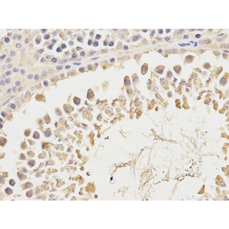 Immunohistochemistry - CA3 Antibody from Signalway Antibody (32231) - Antibodies.com