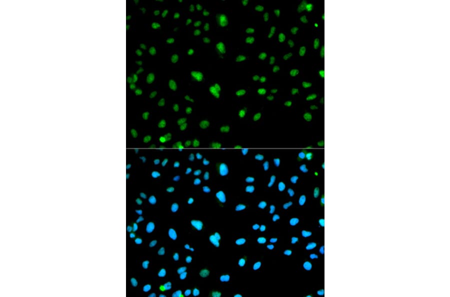 Immunofluorescence - CA3 Antibody from Signalway Antibody (32231) - Antibodies.com