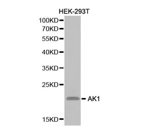 Western blot - AK1 Antibody from Signalway Antibody (32235) - Antibodies.com