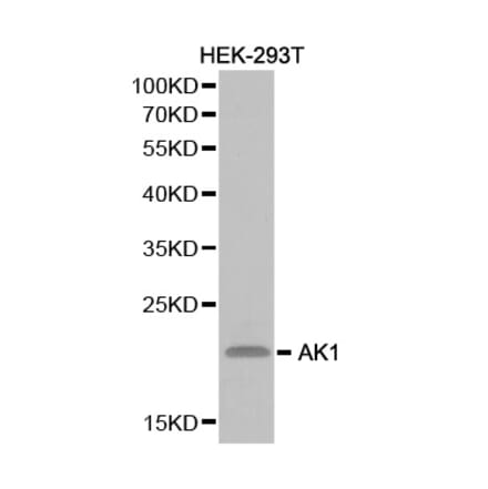 Western blot - AK1 Antibody from Signalway Antibody (32235) - Antibodies.com