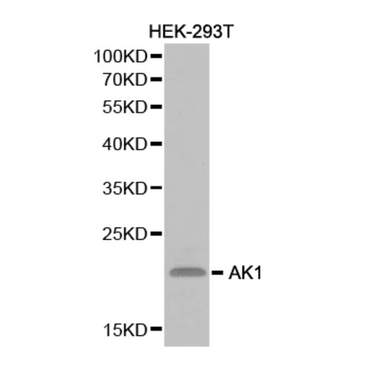 Western blot - AK1 Antibody from Signalway Antibody (32235) - Antibodies.com
