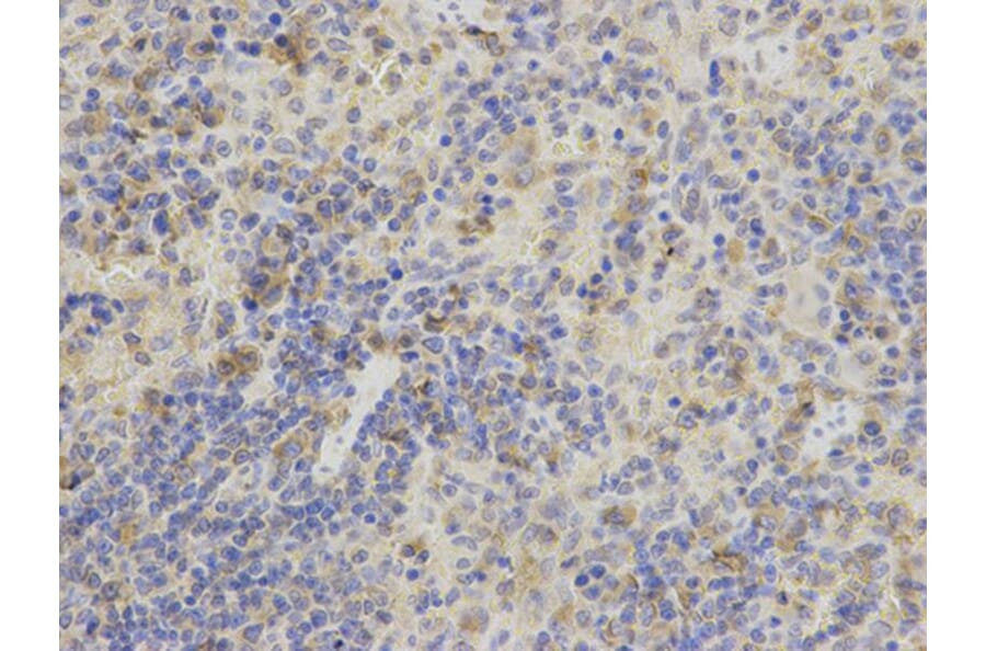 Immunohistochemistry - AK1 Antibody from Signalway Antibody (32235) - Antibodies.com