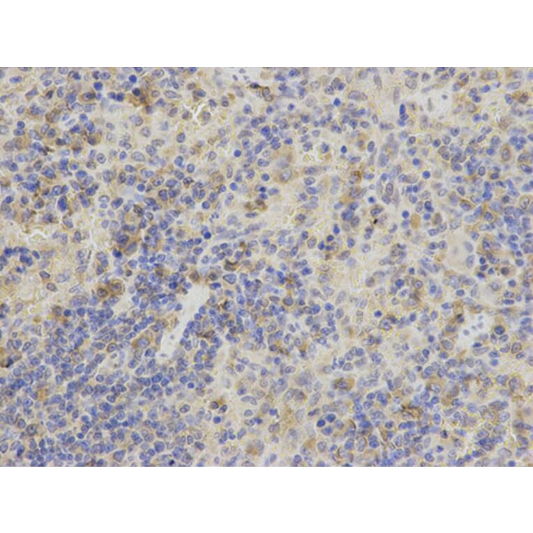 Immunohistochemistry - AK1 Antibody from Signalway Antibody (32235) - Antibodies.com
