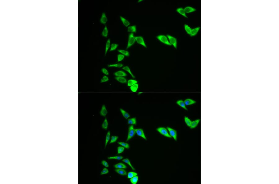 Immunofluorescence - AK1 Antibody from Signalway Antibody (32235) - Antibodies.com