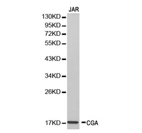 Western blot - CGA Antibody from Signalway Antibody (32250) - Antibodies.com