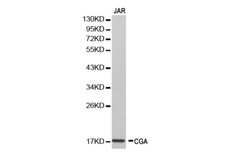 Western blot - CGA Antibody from Signalway Antibody (32250) - Antibodies.com