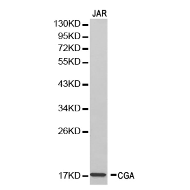 Western blot - CGA Antibody from Signalway Antibody (32250) - Antibodies.com