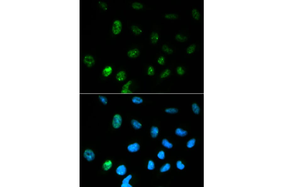 Immunofluorescence - CGA Antibody from Signalway Antibody (32250) - Antibodies.com
