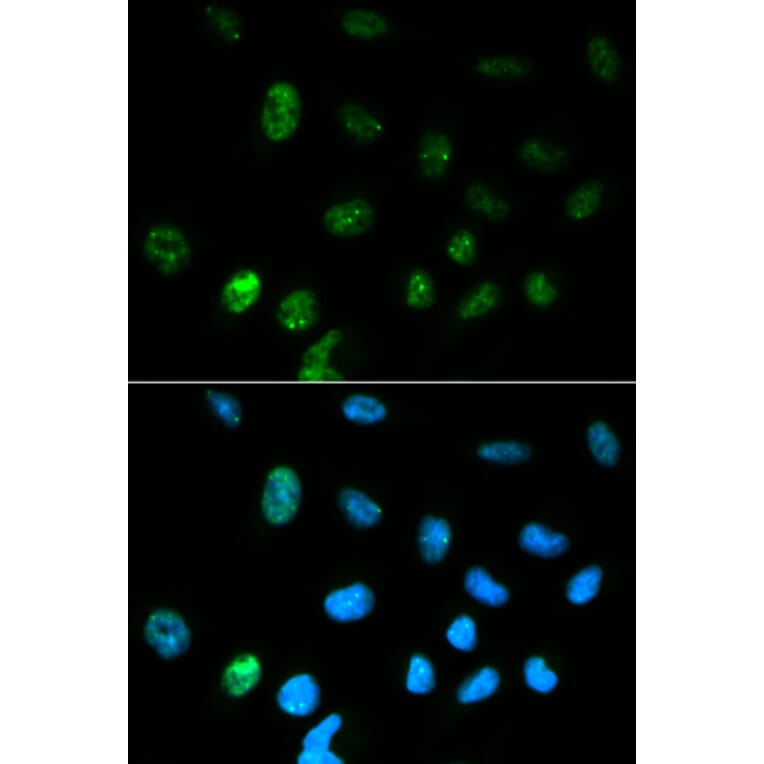 Immunofluorescence - CGA Antibody from Signalway Antibody (32250) - Antibodies.com