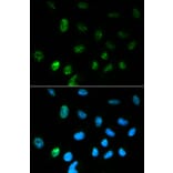 Immunofluorescence - CGA Antibody from Signalway Antibody (32250) - Antibodies.com