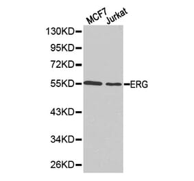 Western blot - ERG Antibody from Signalway Antibody (32251) - Antibodies.com