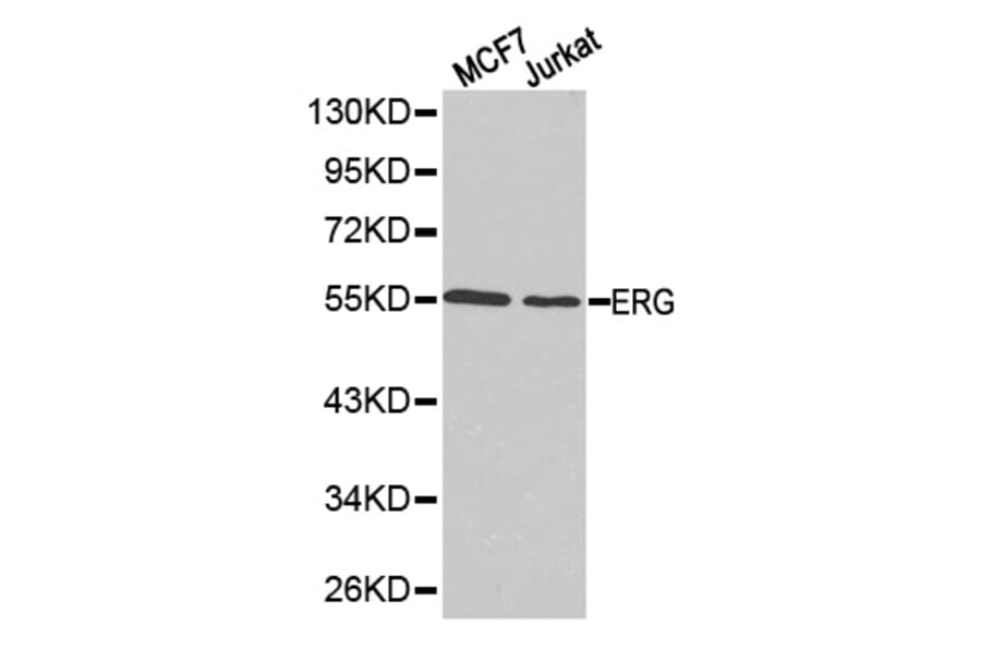 Western blot - ERG Antibody from Signalway Antibody (32251) - Antibodies.com