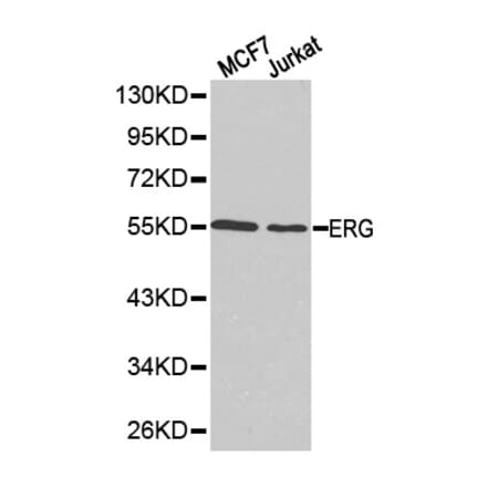 Western blot - ERG Antibody from Signalway Antibody (32251) - Antibodies.com
