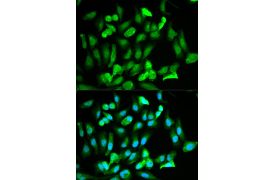 Immunofluorescence - ERG Antibody from Signalway Antibody (32251) - Antibodies.com
