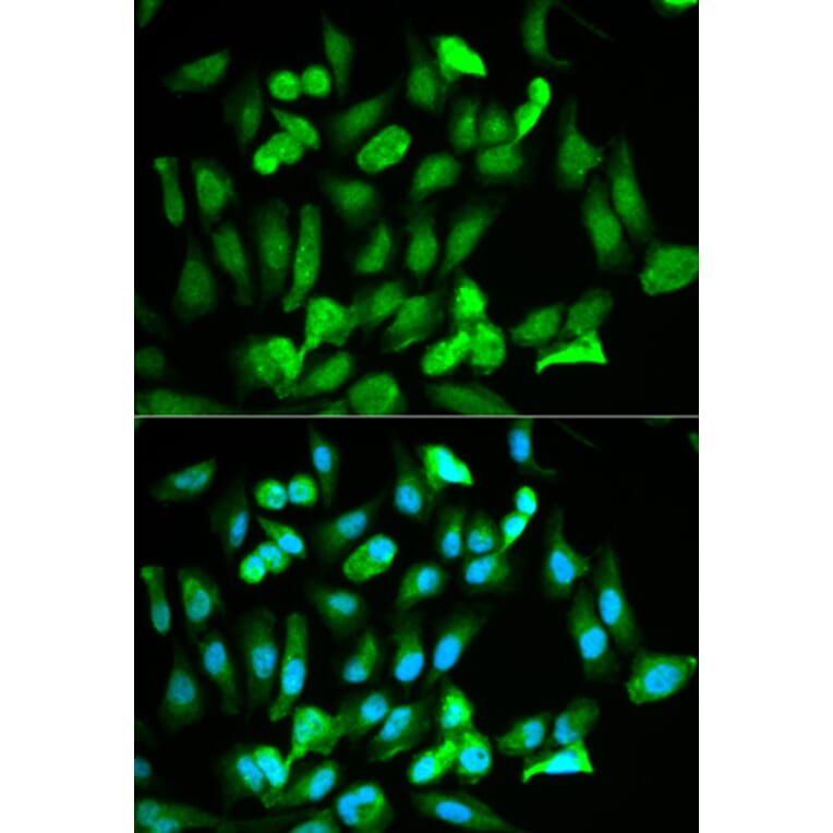 Immunofluorescence - ERG Antibody from Signalway Antibody (32251) - Antibodies.com