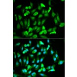 Immunofluorescence - ERG Antibody from Signalway Antibody (32251) - Antibodies.com