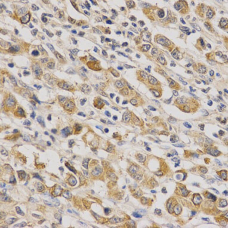 Immunohistochemistry - ERG Antibody from Signalway Antibody (32251) - Antibodies.com