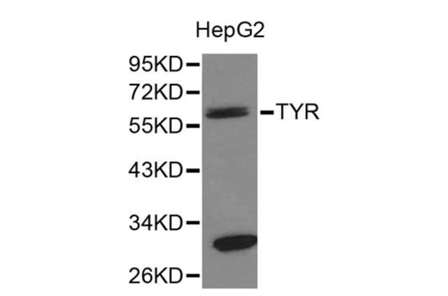 Western blot - TYR Antibody from Signalway Antibody (32259) - Antibodies.com