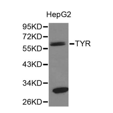 Western blot - TYR Antibody from Signalway Antibody (32259) - Antibodies.com