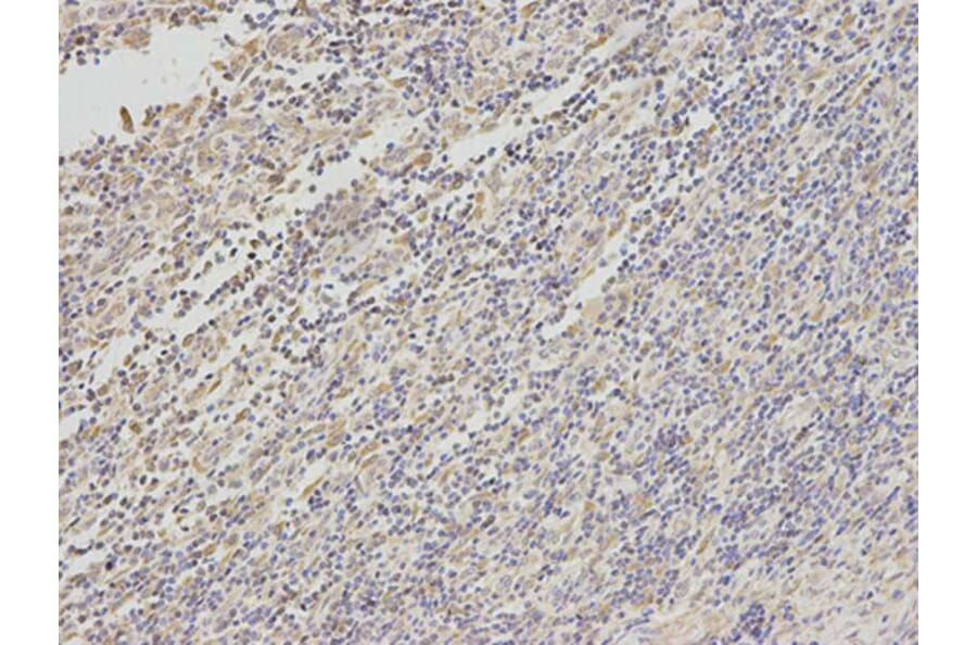 Immunohistochemistry - TYR Antibody from Signalway Antibody (32259) - Antibodies.com