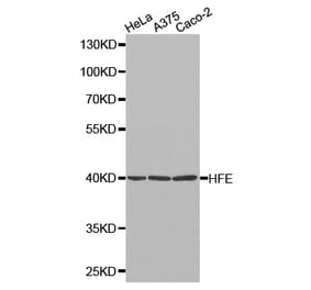 Western blot - HFE Antibody from Signalway Antibody (32264) - Antibodies.com