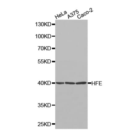 Western blot - HFE Antibody from Signalway Antibody (32264) - Antibodies.com