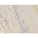 Immunohistochemistry - HFE Antibody from Signalway Antibody (32264) - Antibodies.com